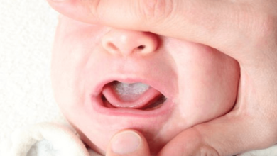 Baby:5dizrd-Icdi= Thrush